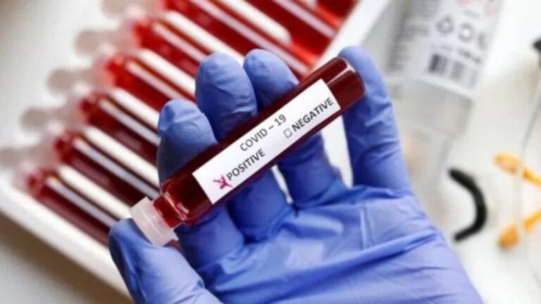 BadlapurTimes | Imp Update COVID-JN.1 व्हेरिएंट